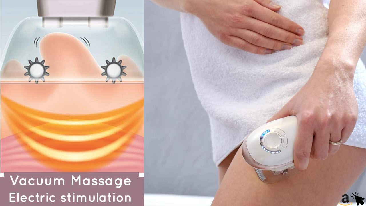 HoMedics Anti-Cellulite-Massagegerät Elektrisches Vakuum-Schröpfgerät - Reduzierung von Orangenhaut und Wasseransammlungen - Hautentgiftung und Fettreduzierung